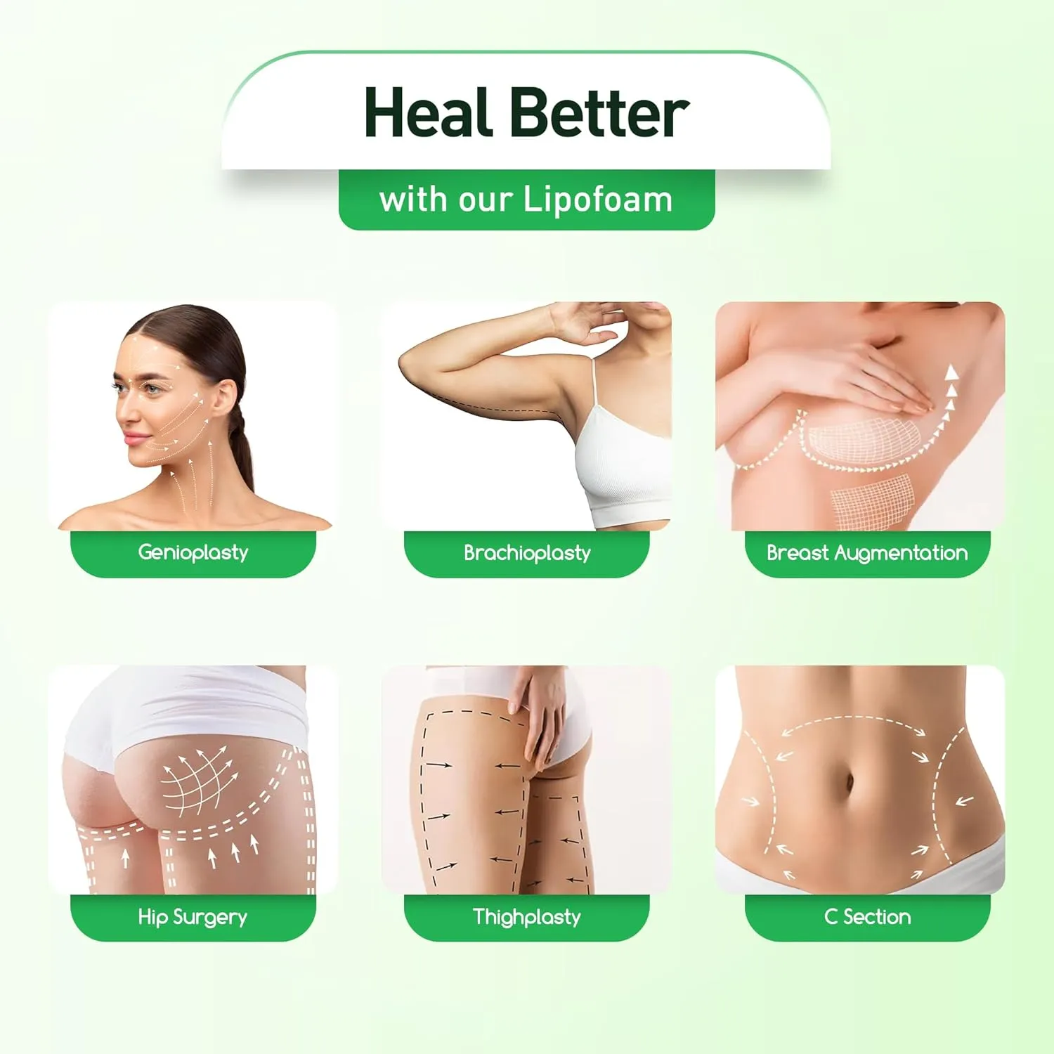 5 Pack Lipo Foam Pads - Post Surgery Ab Board for Liposuction Recovery, Flattening Abdominal Compression Garments for Tummy Tuck Surgery (8” x 11” x 0.5”)